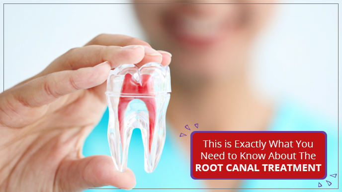 This is Exactly What You Need to Know About The Root Canal Treatment