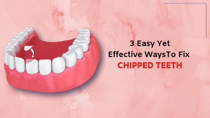 chipped tooth treatment